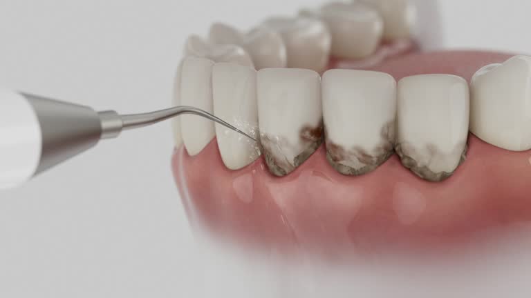 Trusted Teeth Cleaning And Checkup service in Brentwood, TN - Dentist Open Now